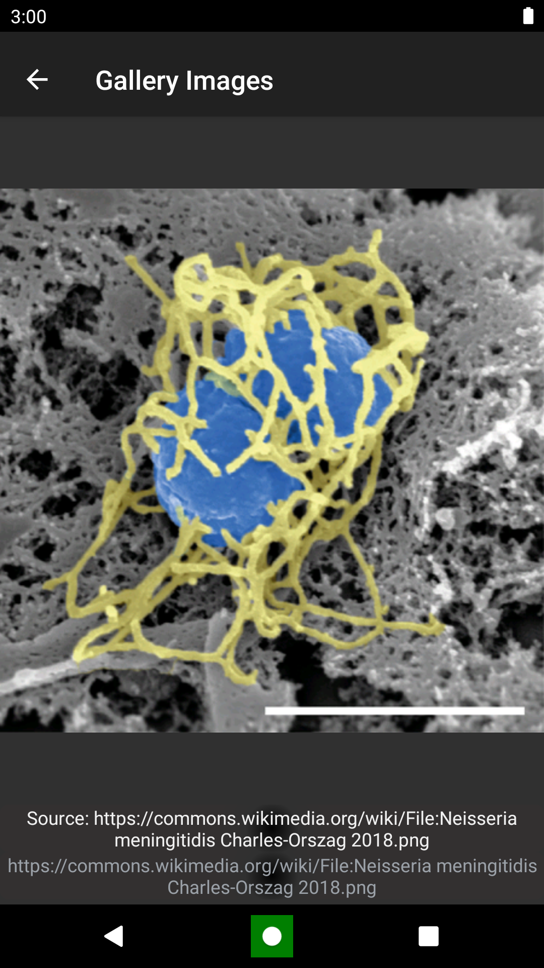 Bacteria: Types, Infections Screenshot5