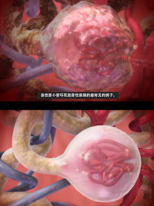 Physiology & Pathology Screenshot11