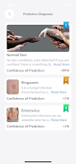 Medeskin AI Screenshot2